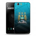 Дизайнерский силиконовый чехол для Doogee X5