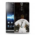 Дизайнерский пластиковый чехол для Sony Xperia S