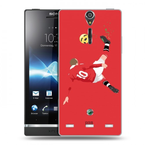 Дизайнерский пластиковый чехол для Sony Xperia S