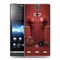 Дизайнерский пластиковый чехол для Sony Xperia S