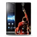 Дизайнерский пластиковый чехол для Sony Xperia S