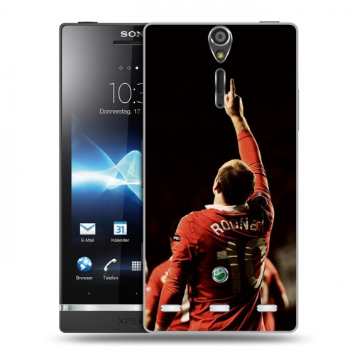 Дизайнерский пластиковый чехол для Sony Xperia S