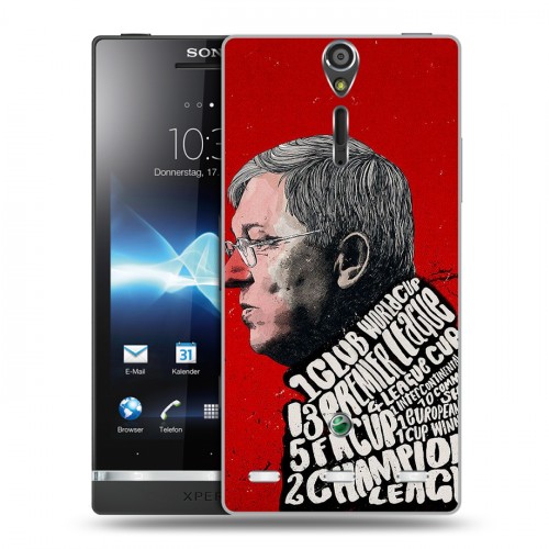 Дизайнерский пластиковый чехол для Sony Xperia S