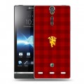 Дизайнерский пластиковый чехол для Sony Xperia S