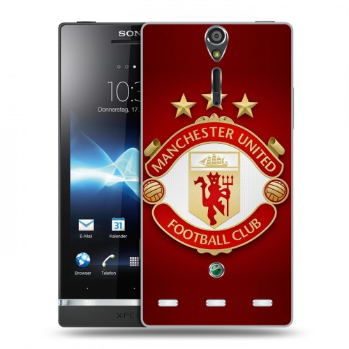 Дизайнерский пластиковый чехол для Sony Xperia S