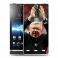 Дизайнерский пластиковый чехол для Sony Xperia S