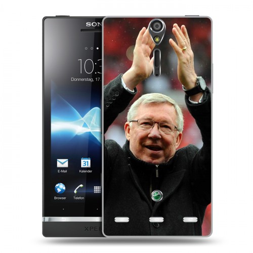 Дизайнерский пластиковый чехол для Sony Xperia S