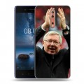 Дизайнерский пластиковый чехол для Nokia 8