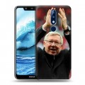 Дизайнерский пластиковый чехол для Nokia 5.1 Plus