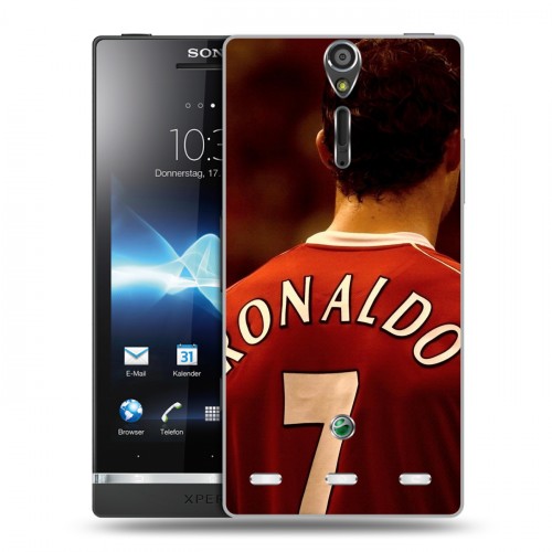 Дизайнерский пластиковый чехол для Sony Xperia S