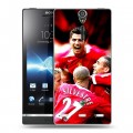 Дизайнерский пластиковый чехол для Sony Xperia S