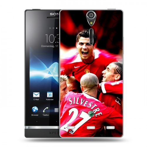 Дизайнерский пластиковый чехол для Sony Xperia S