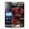 Дизайнерский пластиковый чехол для Sony Xperia S