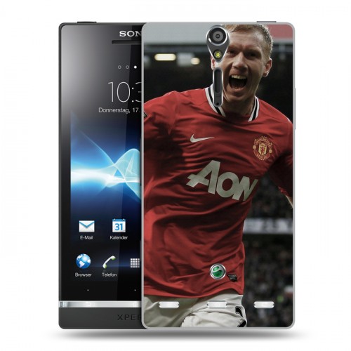 Дизайнерский пластиковый чехол для Sony Xperia S