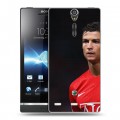 Дизайнерский пластиковый чехол для Sony Xperia S