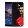 Дизайнерский пластиковый чехол для Nokia 7 Plus