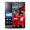 Дизайнерский пластиковый чехол для Sony Xperia S