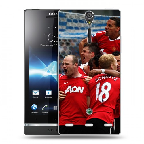 Дизайнерский пластиковый чехол для Sony Xperia S