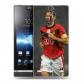 Дизайнерский пластиковый чехол для Sony Xperia S