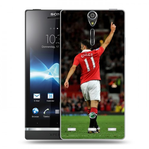 Дизайнерский пластиковый чехол для Sony Xperia S