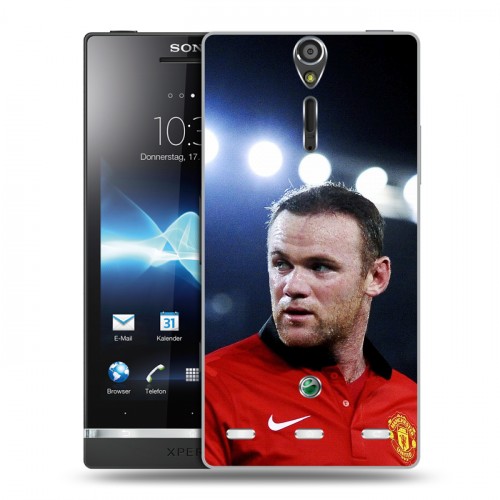 Дизайнерский пластиковый чехол для Sony Xperia S