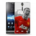 Дизайнерский пластиковый чехол для Sony Xperia S