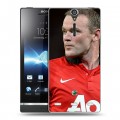 Дизайнерский пластиковый чехол для Sony Xperia S