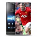 Дизайнерский пластиковый чехол для Sony Xperia S