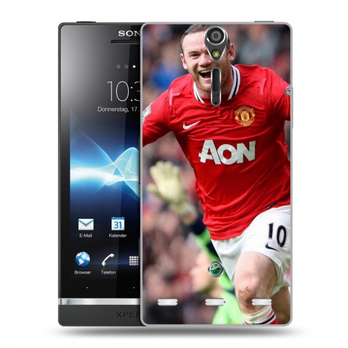 Дизайнерский пластиковый чехол для Sony Xperia S