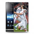 Дизайнерский пластиковый чехол для Sony Xperia S