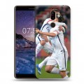 Дизайнерский пластиковый чехол для Nokia 7 Plus