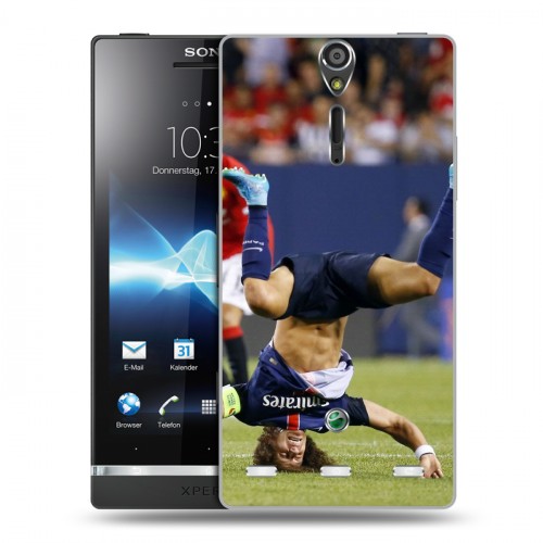 Дизайнерский пластиковый чехол для Sony Xperia S