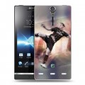 Дизайнерский пластиковый чехол для Sony Xperia S