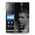 Дизайнерский пластиковый чехол для Sony Xperia S