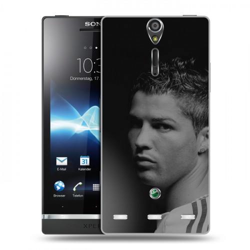 Дизайнерский пластиковый чехол для Sony Xperia S