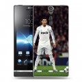 Дизайнерский пластиковый чехол для Sony Xperia S