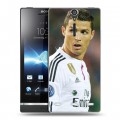 Дизайнерский пластиковый чехол для Sony Xperia S