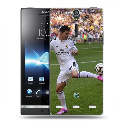 Дизайнерский пластиковый чехол для Sony Xperia S