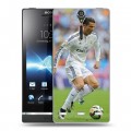 Дизайнерский пластиковый чехол для Sony Xperia S