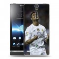 Дизайнерский пластиковый чехол для Sony Xperia S