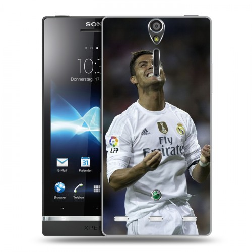 Дизайнерский пластиковый чехол для Sony Xperia S