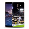 Дизайнерский пластиковый чехол для Nokia 7 Plus