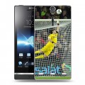 Дизайнерский пластиковый чехол для Sony Xperia S