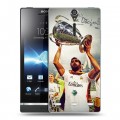 Дизайнерский пластиковый чехол для Sony Xperia S