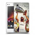 Дизайнерский пластиковый чехол для Sony Xperia L