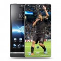 Дизайнерский пластиковый чехол для Sony Xperia S