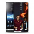 Дизайнерский пластиковый чехол для Sony Xperia S