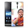 Дизайнерский пластиковый чехол для Sony Xperia S