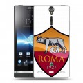 Дизайнерский пластиковый чехол для Sony Xperia S