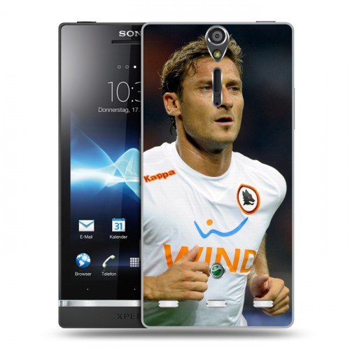 Дизайнерский пластиковый чехол для Sony Xperia S